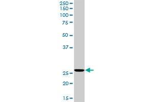 RNH1 MaxPab rabbit polyclonal antibody. (RNH1 anticorps  (AA 1-461))