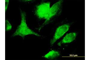 Immunofluorescence of monoclonal antibody to TNFSF6 on HeLa cell. (FASL anticorps  (AA 1-281))