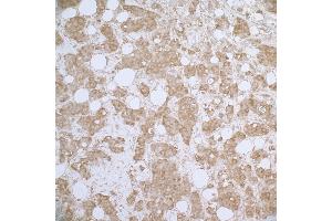 Immunohistochemistry (IHC) image for anti-Heat Shock 27kDa Protein 1 (HSPB1) (AA 150-200) antibody (ABIN7453910) (HSP27 anticorps  (AA 150-200))