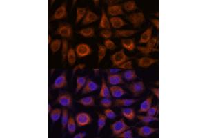 Immunofluorescence analysis of L929 cells using TRIM16 antibody (ABIN7270978) at dilution of 1:100. (TRIM16 anticorps  (AA 1-210))