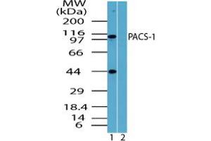 Image no. 1 for anti-phosphofurin Acidic Cluster Sorting Protein 1 (PACS1) (AA 300-350) antibody (ABIN960302) (PACS1 anticorps  (AA 300-350))