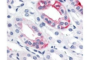 Anti-ESRRG / ERR Gamma antibody IHC of human kidney.