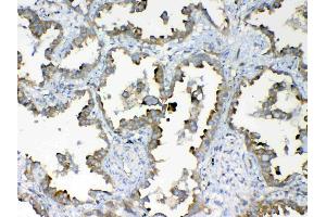 IHC analysis of DYNLT1 using anti-DYNLT1 antibody .