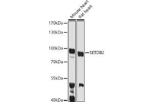 Western blot analysis of extracts of various cell lines, using SETDB2 antibody (ABIN6131576, ABIN6147657, ABIN6147658 and ABIN6223256) at 1:1000 dilution. (SETDB2 anticorps  (AA 1-280))