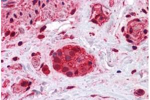 Human Colon, myenteric plexus: Formalin-Fixed, Paraffin-Embedded (FFPE)