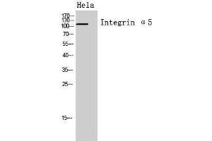 Western Blotting (WB) image for anti-Integrin, alpha 5 (ITGA5) (Internal Region) antibody (ABIN3188019)