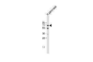 Anti-BACE1 Antibody (N-term) at 1:1000 dilution + human pancreas lysate Lysates/proteins at 20 μg per lane. (BACE1 anticorps  (N-Term))