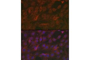 Immunofluorescence analysis of C6 cells using [KO Validated] SOD2 Rabbit pAb (ABIN3021903, ABIN3021904, ABIN3021905 and ABIN6217382) at dilution of 1:200 (40x lens).