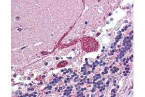 IHC Information: Paraffin embedded brain, cerebellum tissue, tested with an antibody dilution of 5 ug/ml. (ARF6 anticorps  (Middle Region))