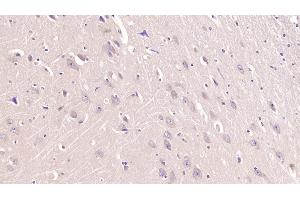 Detection of TFR in Human Cerebrum Tissue using Monoclonal Antibody to Transferrin Receptor (TFR)