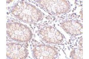 Immunohistochemistry of PTK7 in human colon tissue with PTK7 polyclonal antibody  at 5 ug/mL .