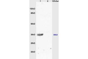Lane 1:mouse kidney lysates Lane 2: mouse brain lysates probed with Anti-MC-1R/MC1 Receptor Polyclonal Antibody, Unconjugated (ABIN686287) at 1:200 in 4 °C.