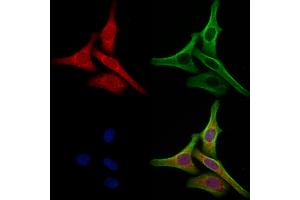 ABIN6265290 and ABIN6273077 staining Hela cells by IF/ICC. (SRP9 anticorps  (Internal Region))