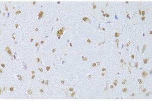 Immunohistochemistry of paraffin-embedded Mouse brain using CDKN1A Polyclonal Antibody at dilution of 1:100 (40x lens). (p21 anticorps)