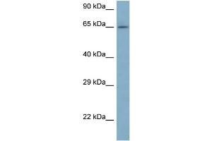 WB Suggested Anti-ARFGAP3 Antibody Titration: 1. (ARFGAP3 anticorps  (N-Term))