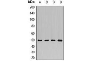 Western blot analysis of ADSS expression in BT474 (A), mouse lung (B), mouse brain (C), rat kidney (D) whole cell lysates.