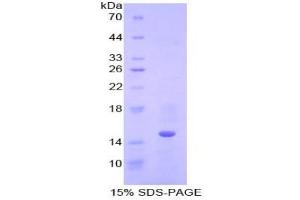 SDS-PAGE analysis of Human Cystatin B Protein. (CSTB Protéine)