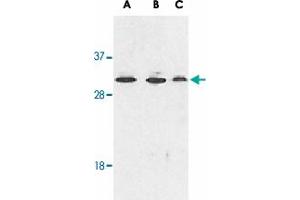 Western blot analysis of RYBP expression in human A-549 (lane A), HepG2 (lane B), and mouse NIH/3T3 (lane C) cell lysates with RYBP polyclonal antibody  at 1 ug /mL . (RYBP anticorps  (AA 215-228))