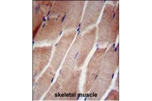 anti-Ribosomal Protein L5 (RPL5) (AA 1-30), (N-Term) antibody