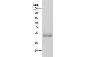 Western Blotting (WB) image for MOB Kinase Activator 1B (MOB1B) (AA 1-216) protein (His tag) (ABIN7124009) (MOBKL1A Protein (AA 1-216) (His tag))