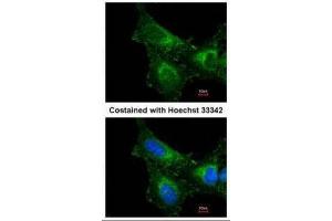ICC/IF Image Immunofluorescence analysis of methanol-fixed HeLa, using PRX I, antibody at 1:200 dilution. (Peroxiredoxin 1 anticorps)