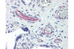 Anti-RND3 antibody IHC of human placenta. (RND3 anticorps  (AA 1-245))