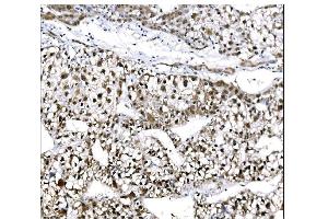 IHC analysis of EHMT2/G9A using anti-EHMT2/G9A antibody (ABIN7602084). (EHMT2 anticorps  (AA 580-1195))