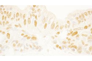 Immunohistochemistry (IHC) image for anti-Zinc Finger, MYM-Type 2 (ZMYM2) (AA 1327-1377) antibody (ABIN7454775)