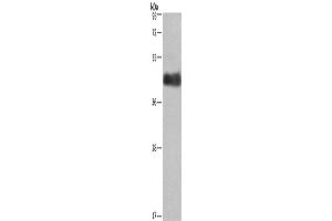 Western Blotting (WB) image for anti-Calumenin (CALU) antibody (ABIN2429669) (CALU anticorps)