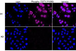 Immunocytochemical staining of HepG2 cells using Phospho-EGFR (Y) antibody (ABIN7798468), 1:1,000), Top panel: wild-type (WT), Bottom panal: Phospho-EGFR (Y) shRNA knockdown (KD).