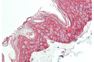 Rabbit Anti-LETMD1 antibody Catalog Number: ARP44736 Formalin Fixed Paraffin Embedded Tissue: Human Skin Primary antibody Concentration: 1:100 Secondary Antibody: Donkey anti-Rabbit-Cy3 Secondary Antibody Concentration: 1:200 Magnification: 20x Exposure Time: 0.