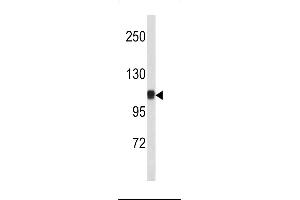 Western blot analysis of CTNA1 antibody (N-term) (ABIN390505 and ABIN2840861) in mouse bladder tissue lysates (35 μg/lane).