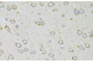 Immunohistochemistry of paraffin-embedded Rat brain using RPL13 Polyclonal Antibody at dilution of 1:100 (40x lens). (RPL13 anticorps)