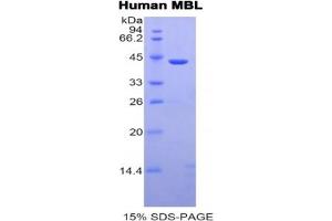 SDS-PAGE analysis of Human MBL2 Protein. (MBL2 Protéine)