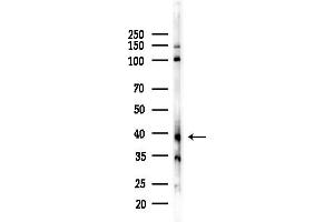 anti-Dopamine Receptor D3 (DRD3) (Internal Region) antibody