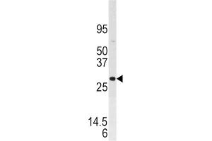 Western Blotting (WB) image for anti-Dual Specificity Phosphatase 3 (DUSP3) antibody (ABIN3003774) (Dual Specificity Phosphatase 3 (DUSP3) anticorps)