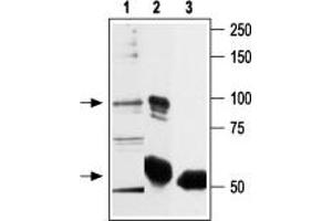 Immunoprecipitation of rat basophilic leukemia (RBL) lysate: - 1. (TRPV2 anticorps  (C-Term, Intracellular))