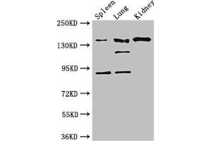 Western Blot Positive WB detected in: Mouse spleen tissue, Mouse lung tissue, Mouse kidney tissue All lanes: NOS1 antibody at 3 μg/mL Secondary Goat polyclonal to rabbit IgG at 1/50000 dilution Predicted band size: 161, 149, 126, 44, 165 kDa Observed band size: 161, 126, 92 kDa (NOS1 anticorps  (AA 655-875))