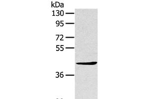 Western Blot analysis of A431 cell using TNIP2 Polyclonal Antibody at dilution of 1:500 (TNIP2 anticorps)