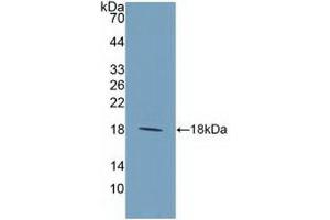 Detection of Recombinant IL9, Human using Polyclonal Antibody to Interleukin 9 (IL9) (IL-9 anticorps  (AA 19-144))