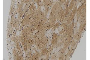 ABIN6272881 at 1/100 staining Mouse heart tissue by IHC-P. (TMPRSS4 anticorps  (Internal Region))
