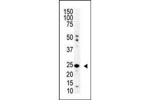 Western blot analysis of SENP8 polyclonal antibody (ABIN388073 and ABIN2845796) in mouse spleen lysate.