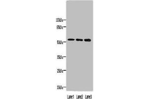 Western blot All lanes: MINDY1 antibody at 8 μg/mL Lane 1: Mouse liver tissue Lane 2: A549 whole cell lysate Lane 3: HepG2 whole cell lysate Secondary Goat polyclonal to rabbit IgG at 1/10000 dilution Predicted band size: 52, 37, 57, 42 kDa Observed band size: 52 kDa (Ubiquitin Carboxyl-Terminal Hydrolase MINDY-1 (MINDY1) (AA 3-278), (C-Term) anticorps)