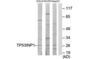 Western blot analysis of extracts from COLO205/HuvEc/HepG2 cells, using TP53INP1 Antibody. (TP53INP1 anticorps  (AA 171-220))