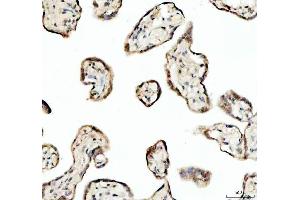 IHC analysis of SP6 using anti-SP6 antibody (ABIN5692945). (SP6 anticorps)