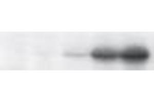 Western Blotting (WB) image for anti-Tumor Protein P53 (TP53) (pSer46) antibody (ABIN3201005) (p53 anticorps  (pSer46))