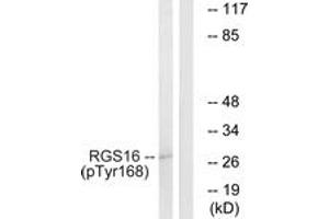 Western blot analysis of extracts from COS7 cells treated with heat shock, using RGS16 (Phospho-Tyr168) Antibody. (RGS16 anticorps  (pTyr168))