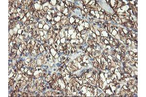 Image no. 2 for anti-Glutamyl Aminopeptidase (Aminopeptidase A) (ENPEP) antibody (ABIN1498029)