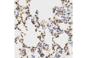 Immunohistochemistry of paraffin-embedded rat lung using DiMethyl-Histone H3-K9 antibody (ABIN1872998) at dilution of 1:200 (40x lens).
