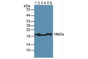 Figure. (MYL2 anticorps  (AA 2-159))